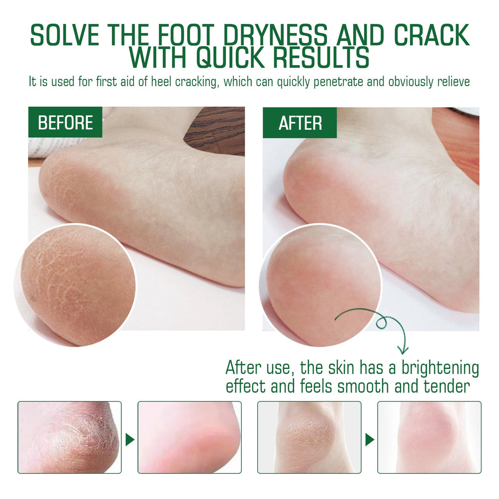 Chapped Heel Care Cream Repair Heel Peeling, Anti-Cracking And Moisturizing Foot Care Cream
