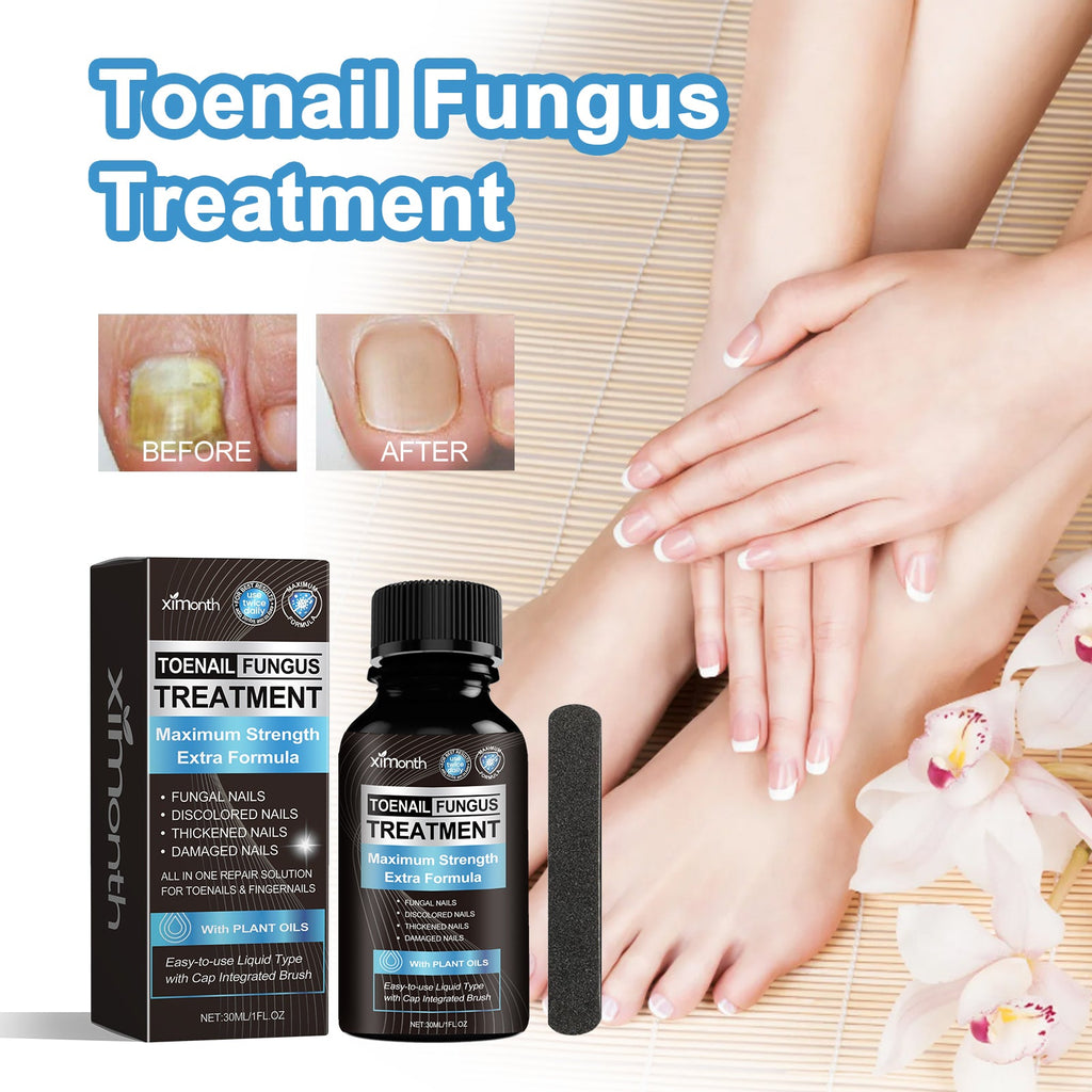 Toenail Fungus Treatment, Repair The Brotherhood Of Nails Rotten Jiasheng Mail This Soft Armour A Detailer